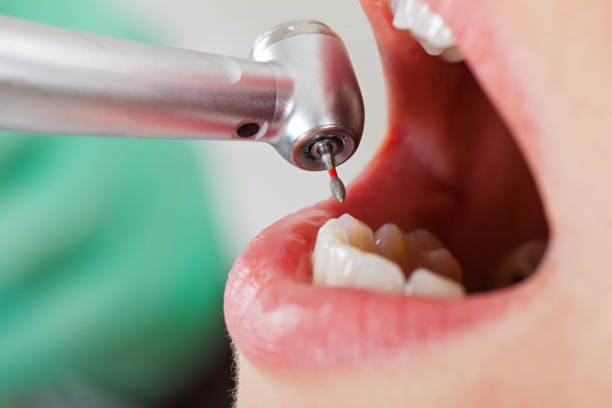 Best Emergency Denture Repair in Mmaduke, AR